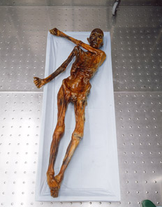 Ötzi laid out on a table