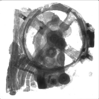Radiograph of the Mechanism
